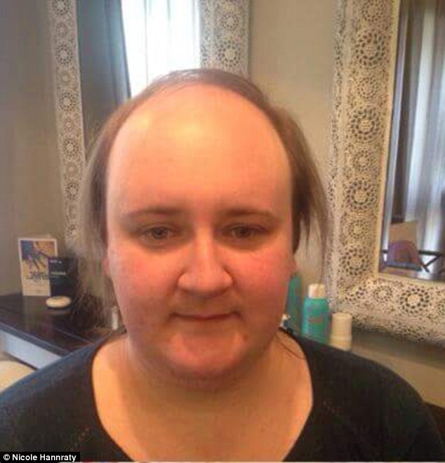 0578-3776101-Nicola_Hanratty_pictured_above_before_and_after_with_her_glued_o-m-17_1473175881625.jpg