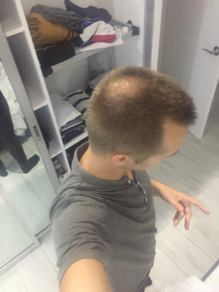 1-longer-hair.jpg