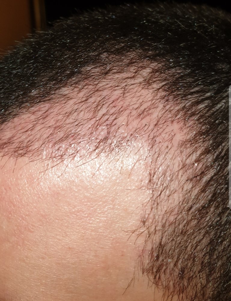 1 month 2.jpg