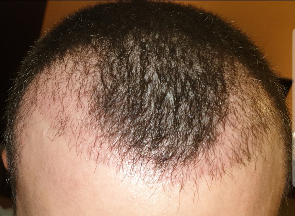 1 month 3.jpg