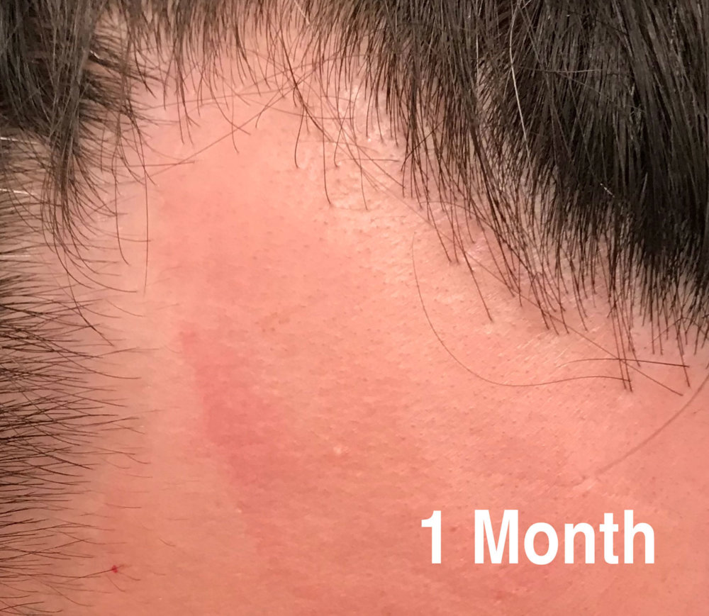 1-month.jpg
