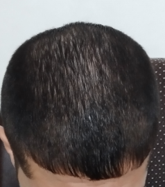 1.PNG