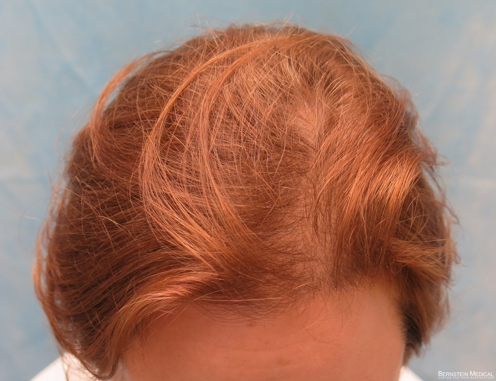 1a_before-transplant-top-view_anj.jpg