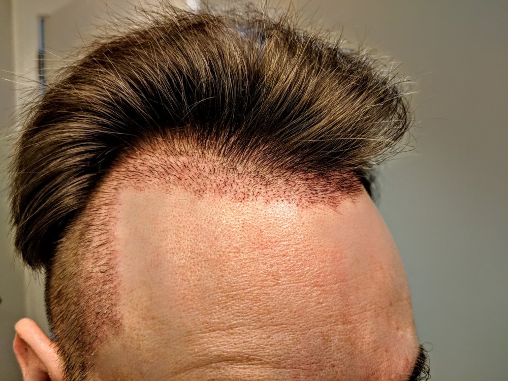 1side.jpg