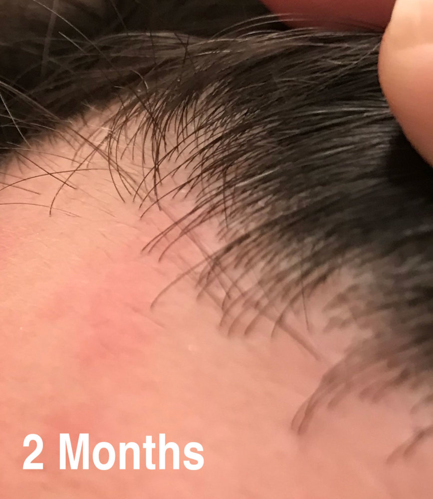 2-month-2.jpg