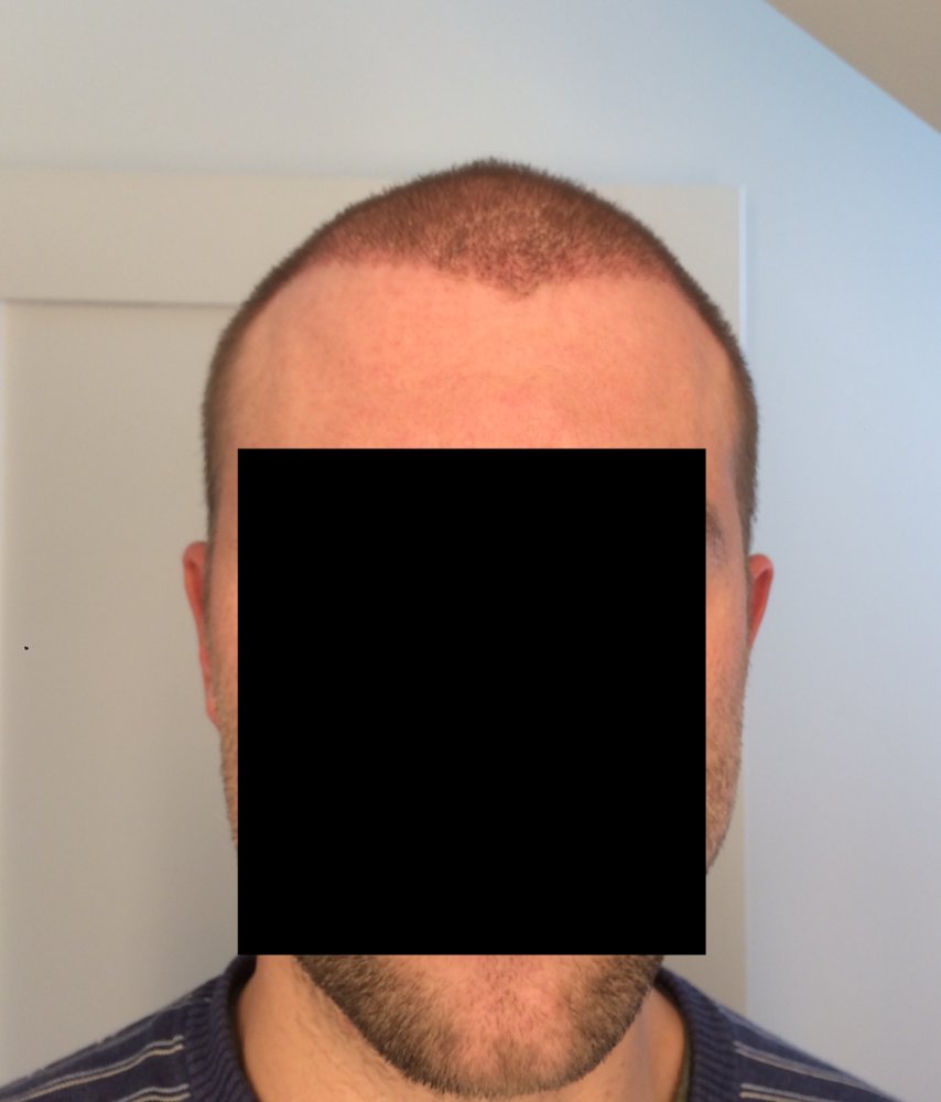 2 weeks front.jpg