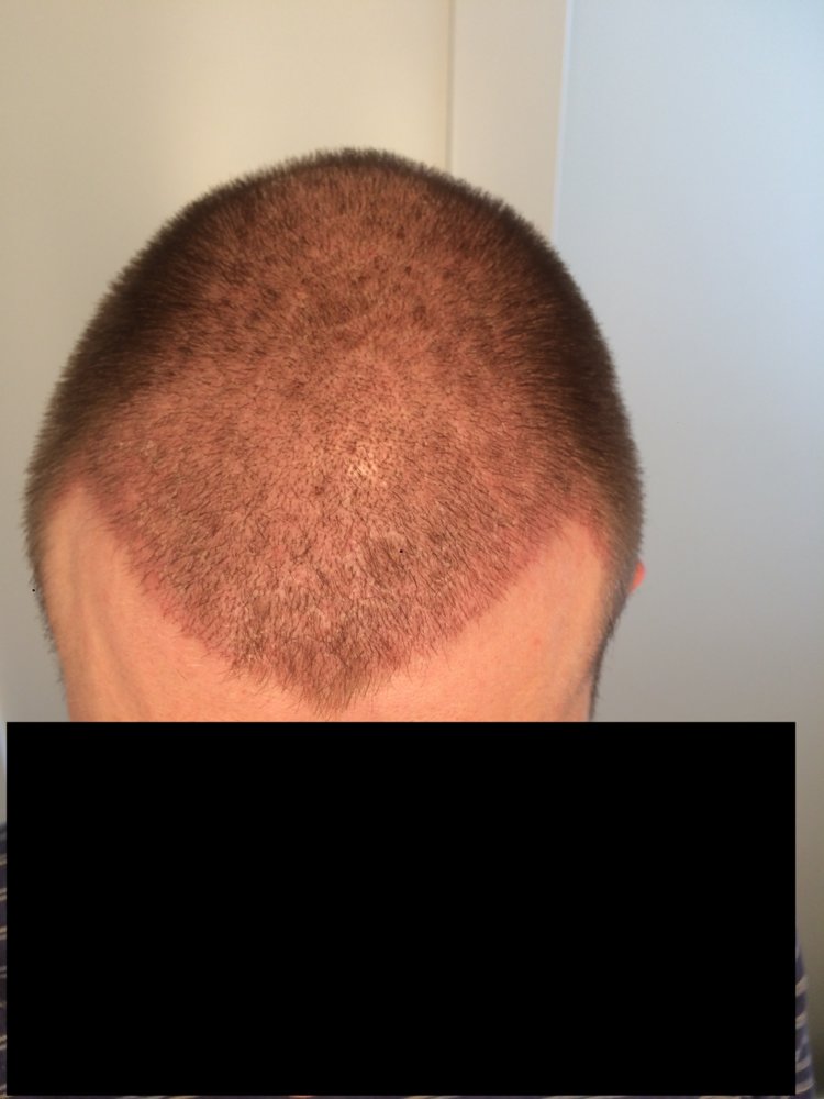 2 weeks top.jpg
