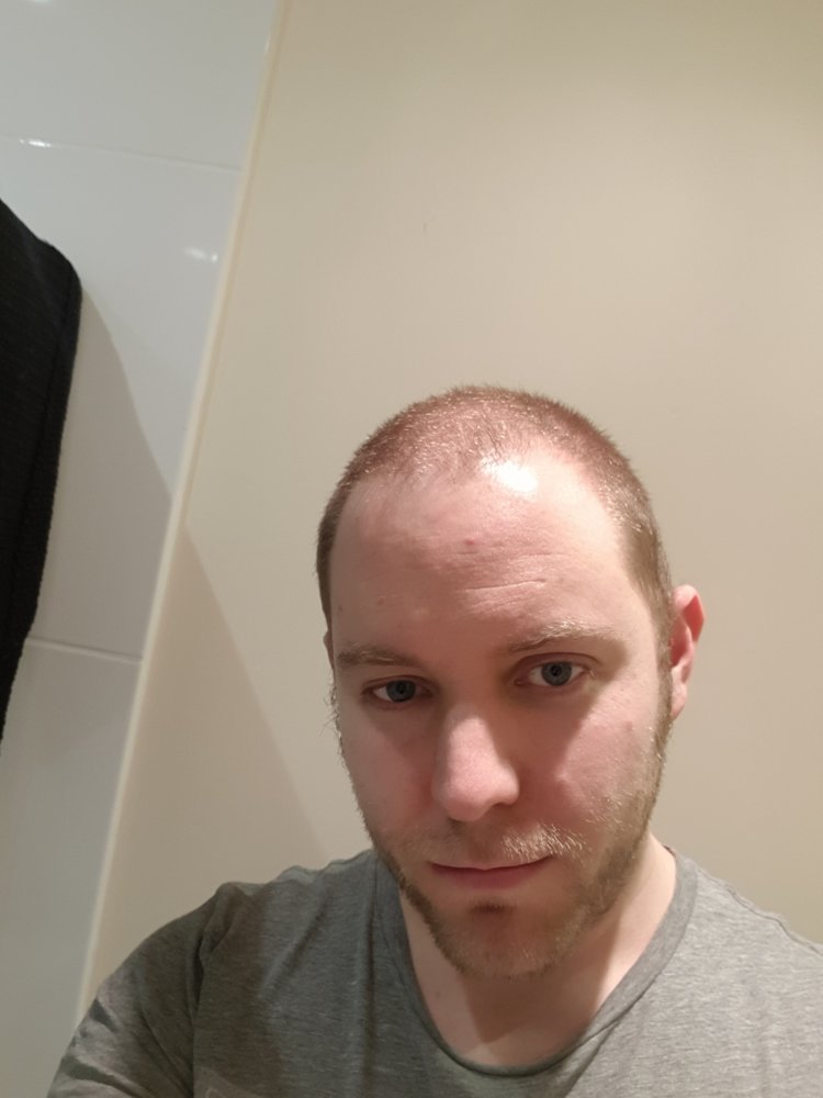20180308_204418.jpg