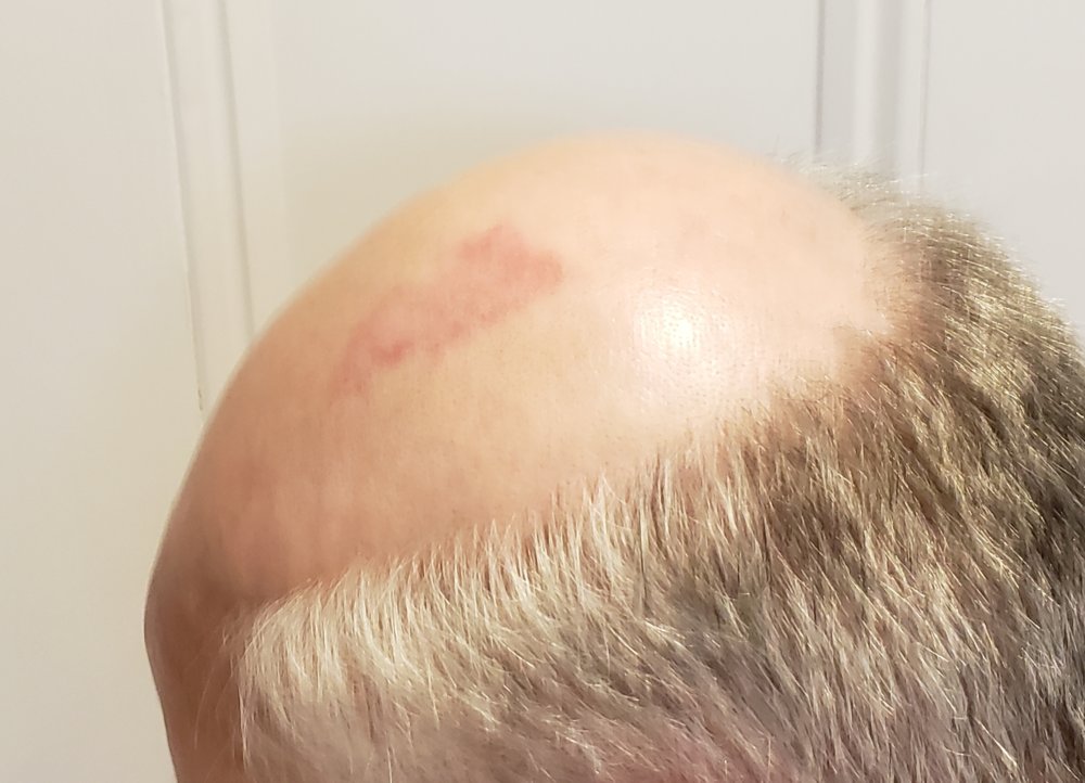 20180730_184437.jpg