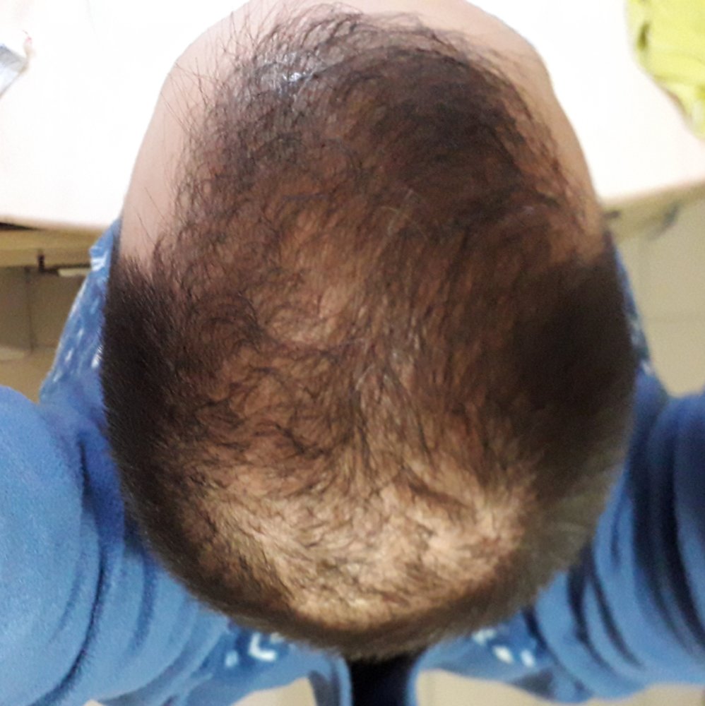 20190414_180002.jpg