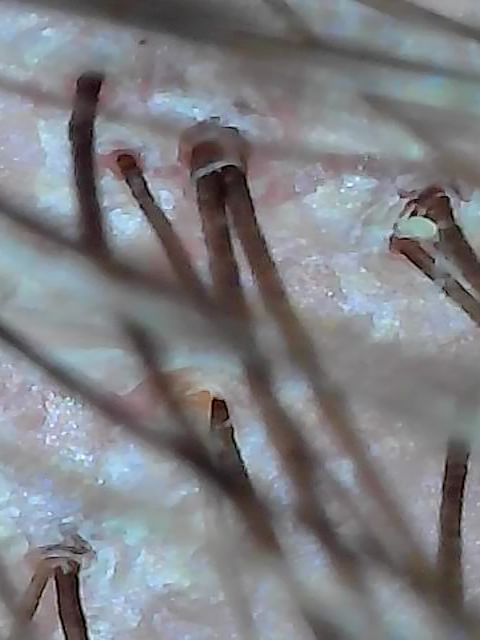 2025_04_18_23_28_21_130-1.png
