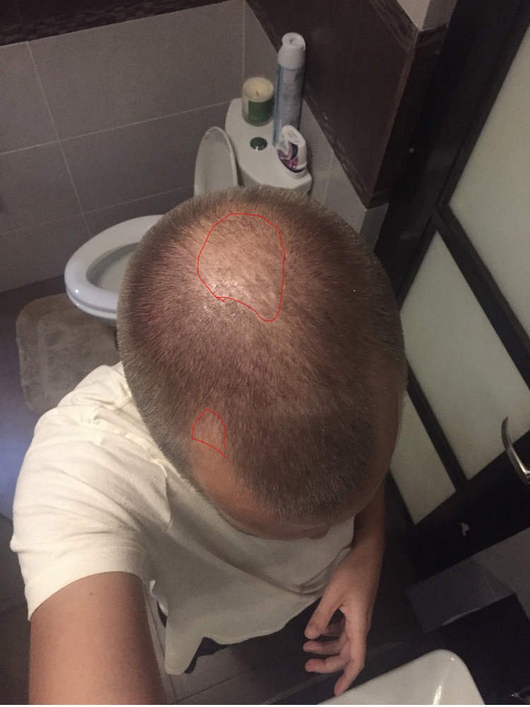 5-red-lined.jpg