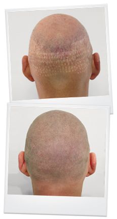 587978cd2d88134b00c42059723b5a71--shaved-heads-pigmentation.jpg