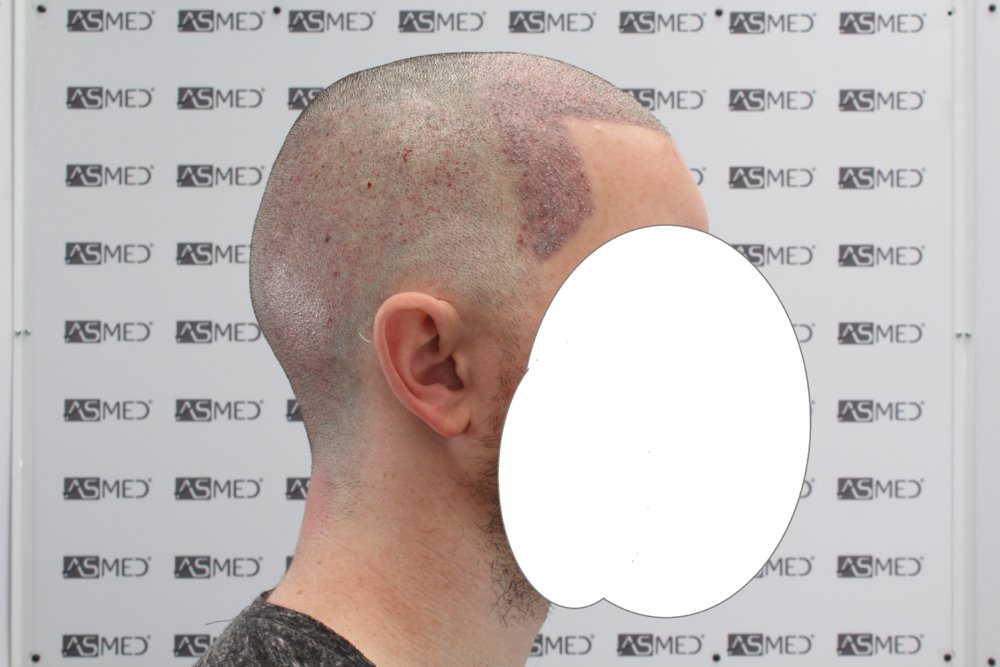 635_Sag.JPG