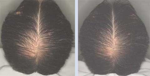 adenogen-before-after.jpg