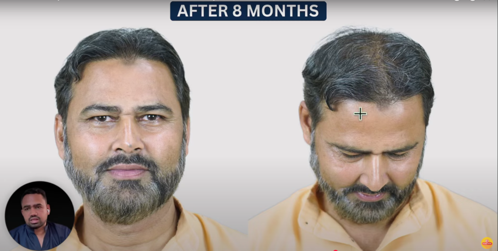 after 8 month.png