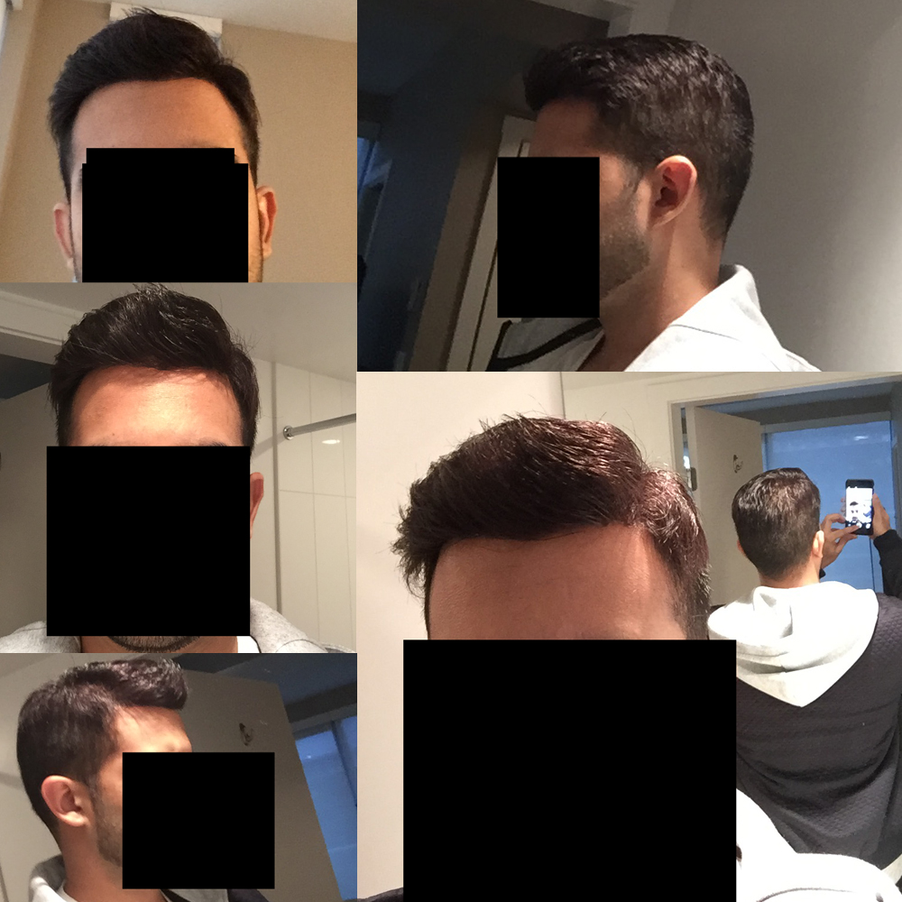 after.jpg