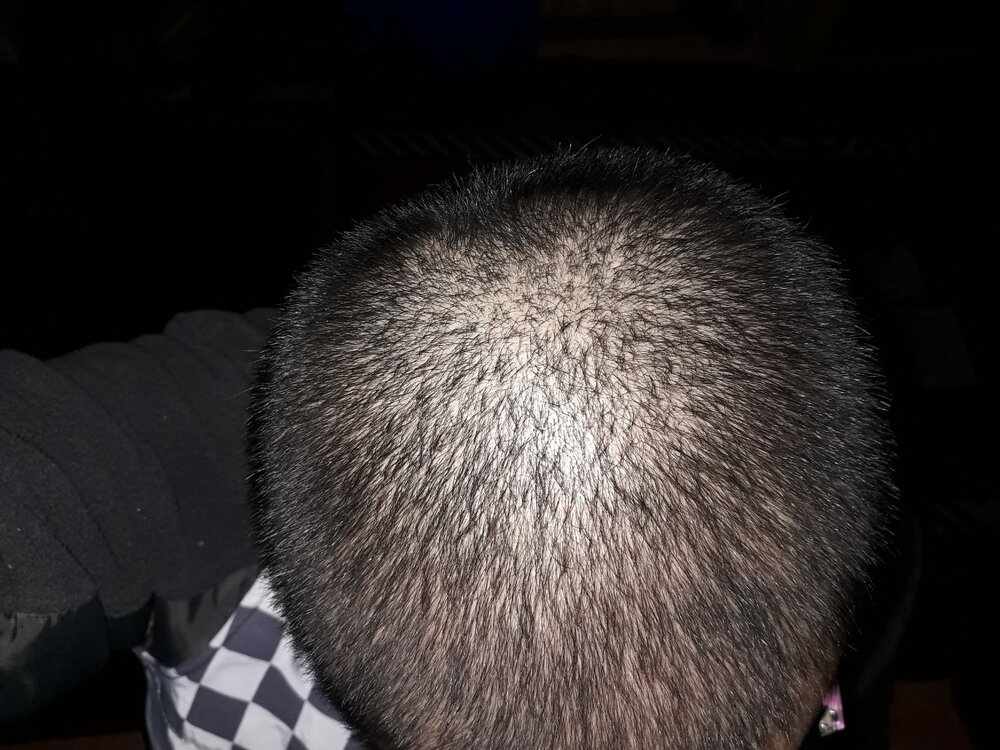 after.jpg