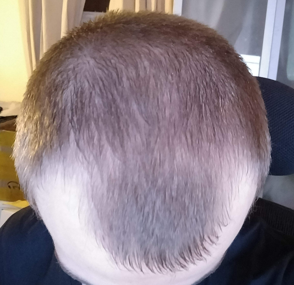 agHLZDY.jpg