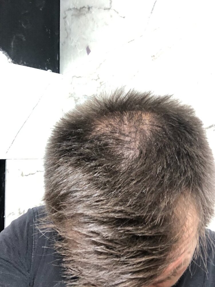 B4443CF6-3E44-45EE-949C-D5452430FACA.thumb.jpeg.bf62e168cf9ae023d7804225cf9aa7f1.jpeg
