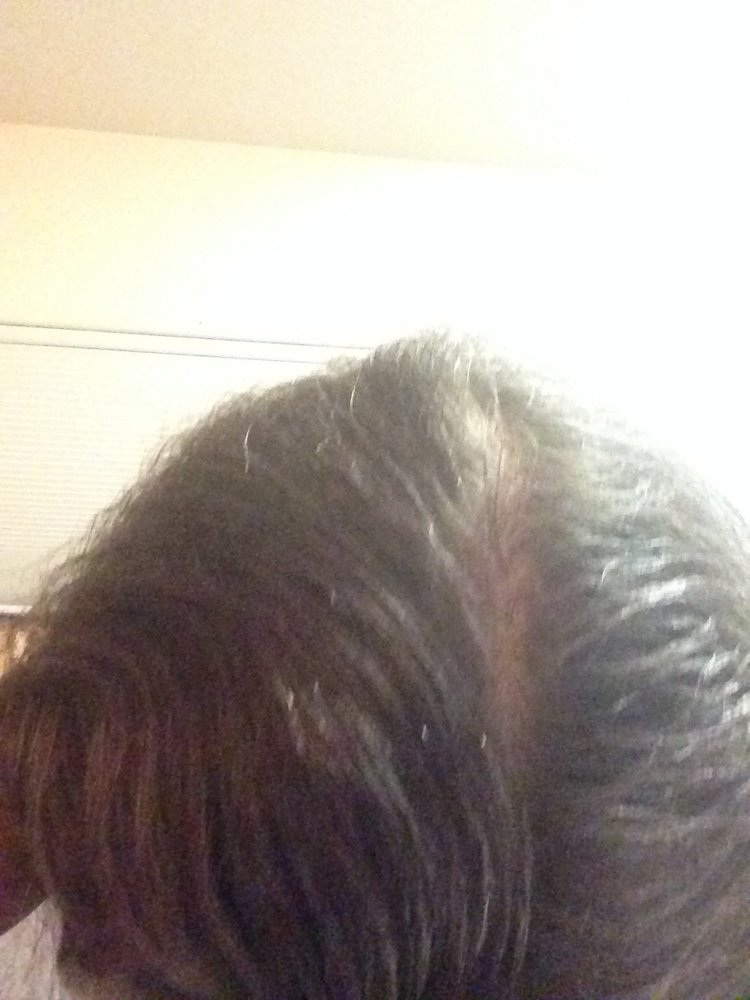 back crown.JPG