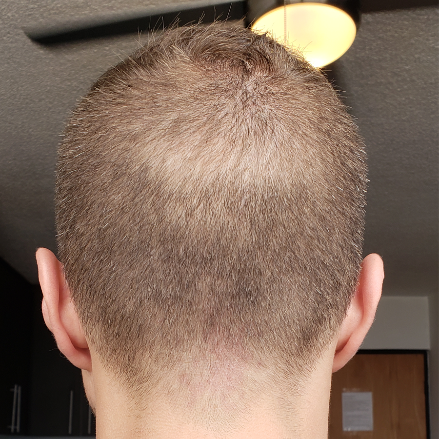 back small.png