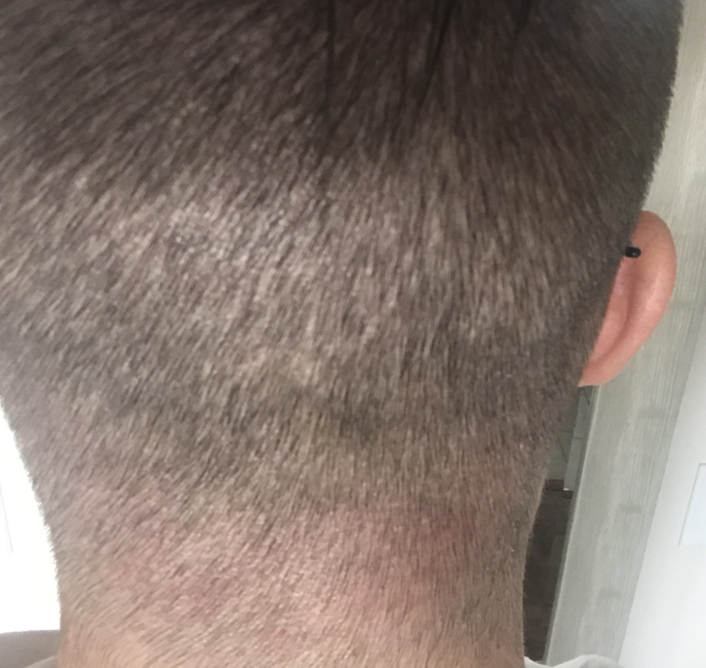 BackDonor_TP3_Day8.png