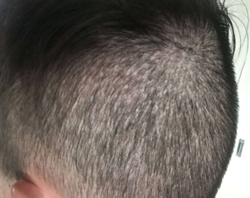 BackLeft_TP3_2weeks.png
