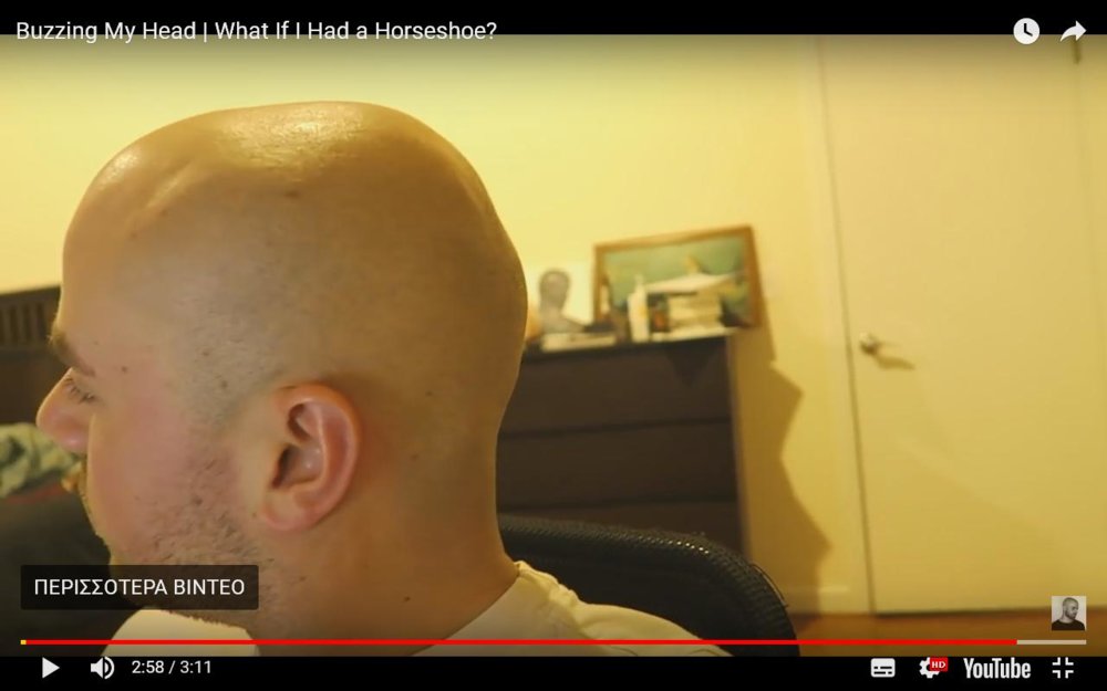 bald.JPG