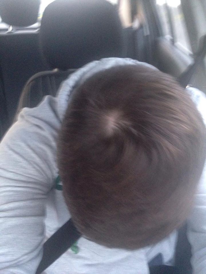 bald3.jpg