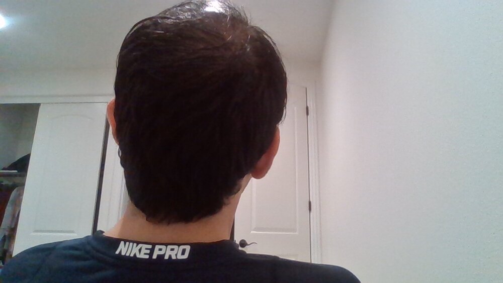 balding 2.jpg