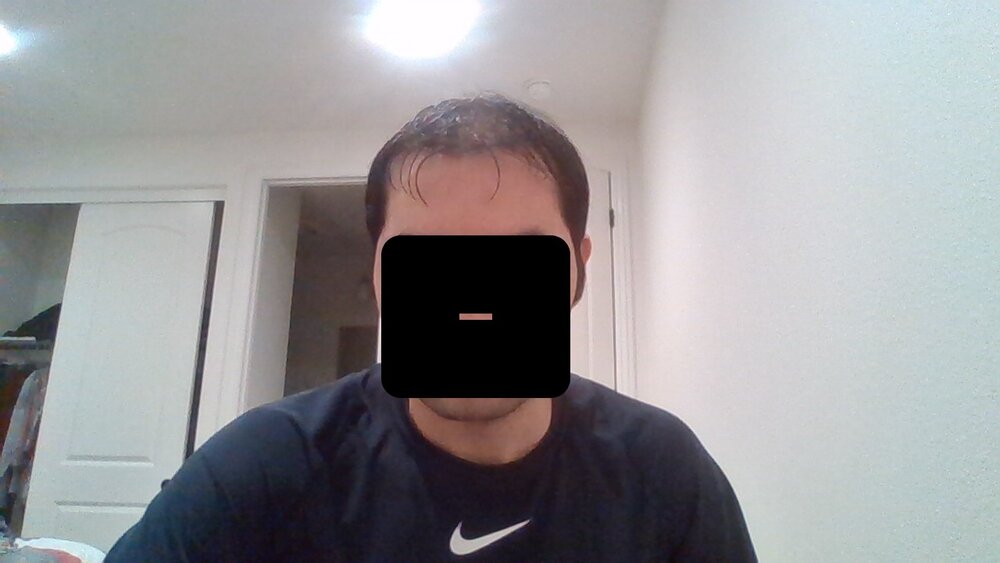 balding 3.jpg