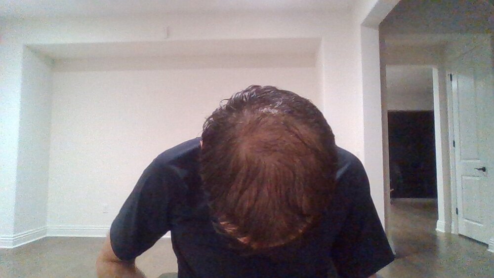 balding.jpg