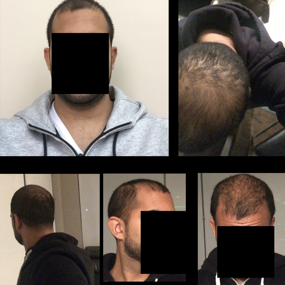 before.jpg