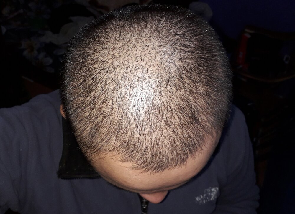 before.jpg