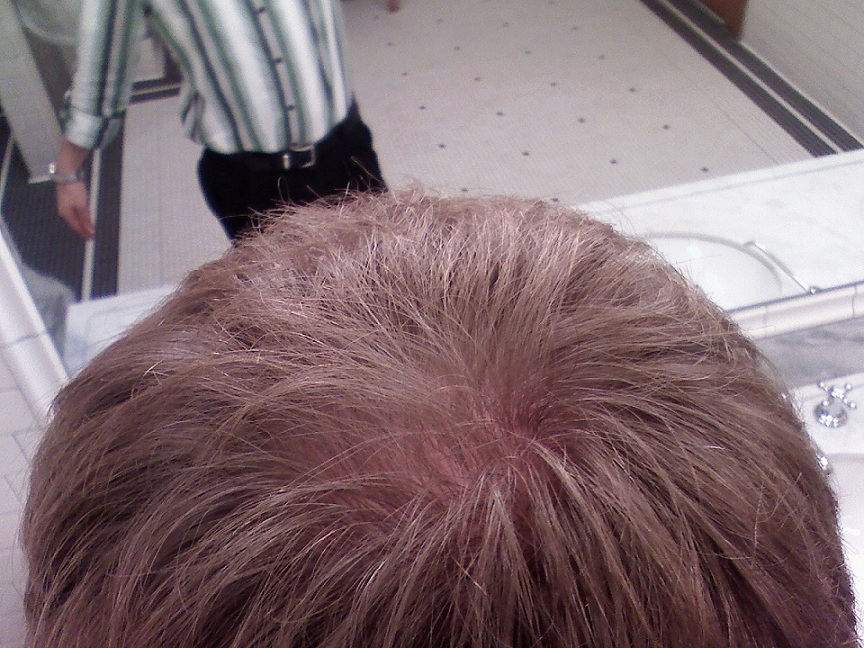 before.jpg