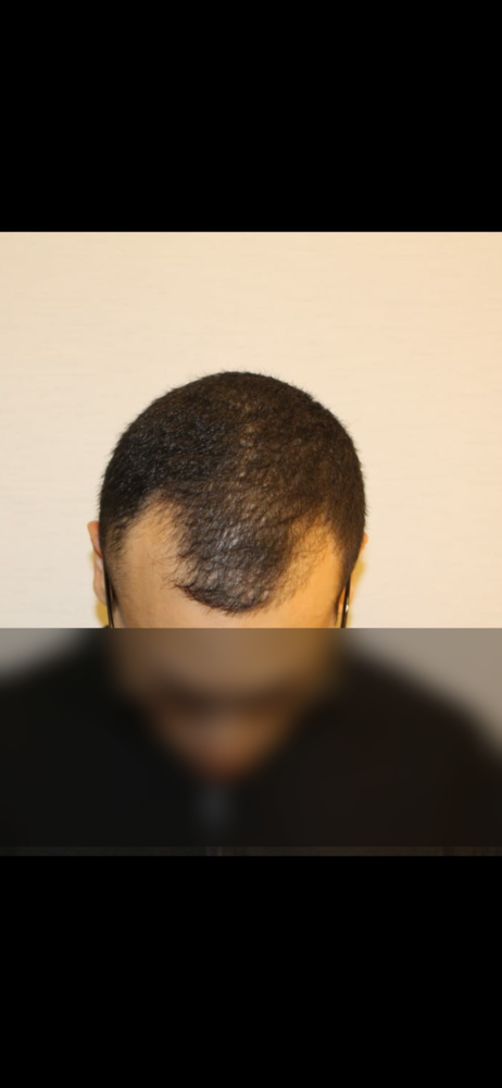 Before.png