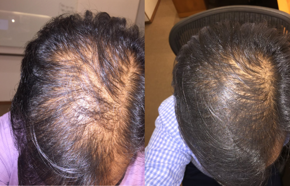 Before_After.png