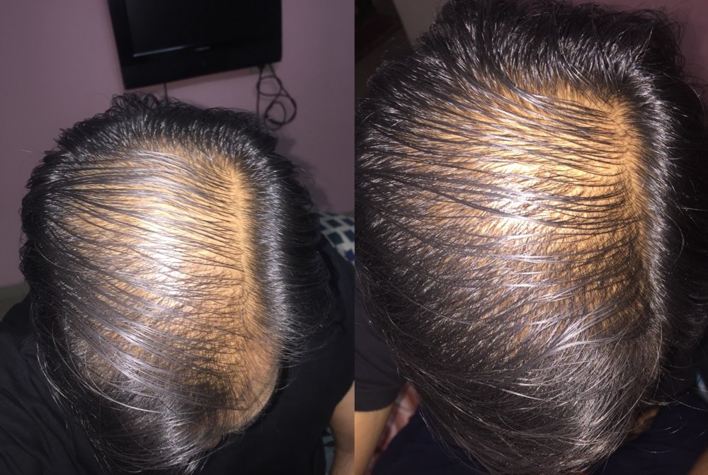 before_after_3_months.jpg