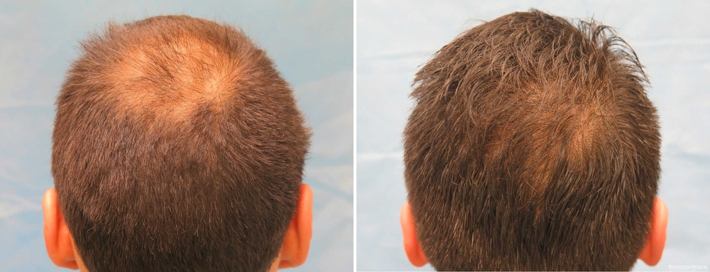 before_and_after_avq.jpg