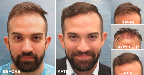 beforeafter_fb_cfq.jpg