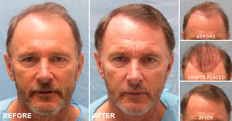 beforeafter_fb_gmz.jpg
