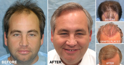 beforeafter_fb_hyc.jpg