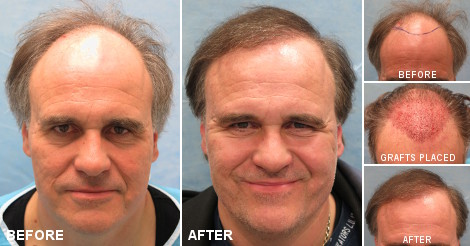 beforeafter_fb_ioi.jpg