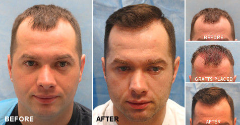beforeafter_fb_kzk.jpg
