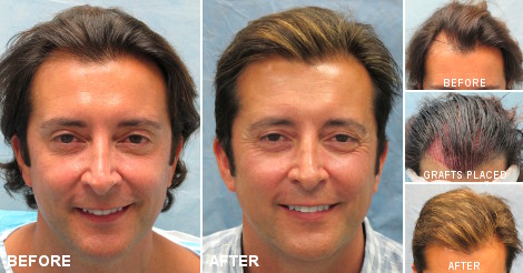 beforeafter_fb_odq.jpg