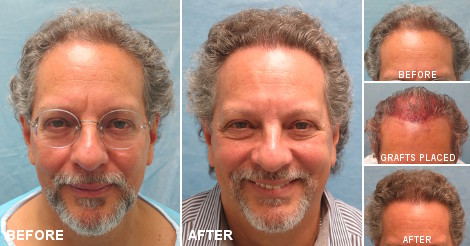 beforeafter_fb_qwe.jpg