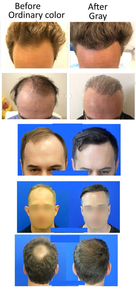 beforeaftergrey-resized.jpg