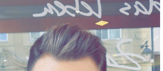 BeforeHairLoss.png
