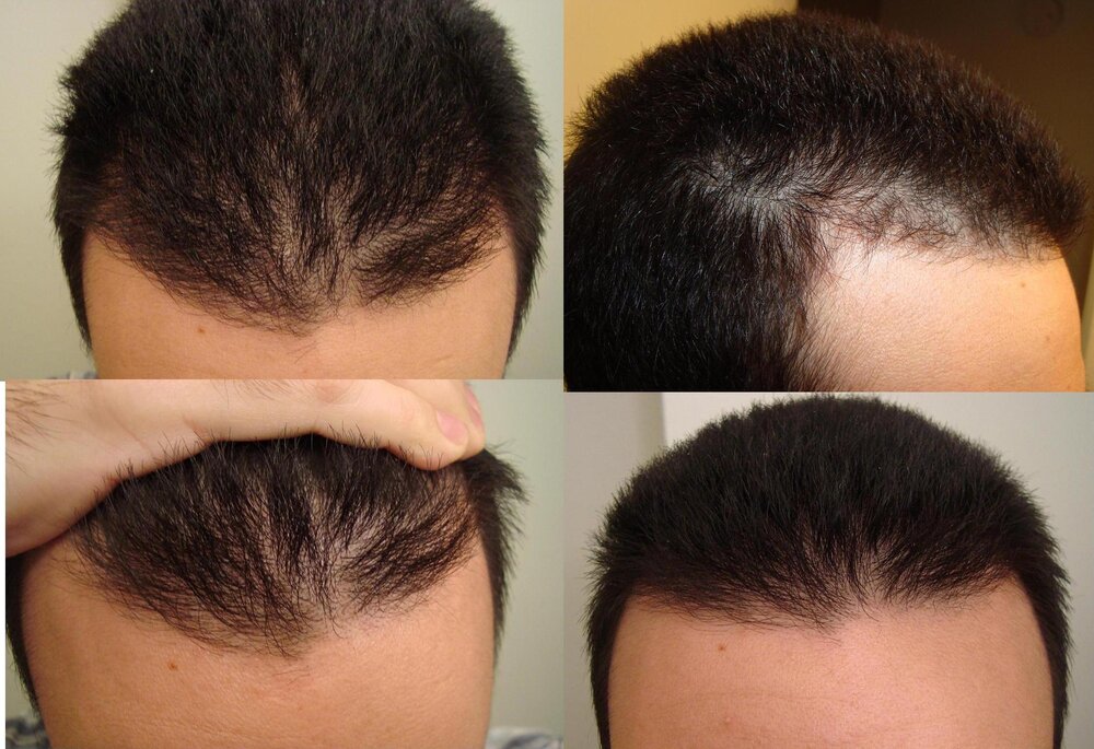beforetreatmentall.jpg
